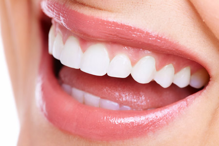 Periodontal treatment illustration