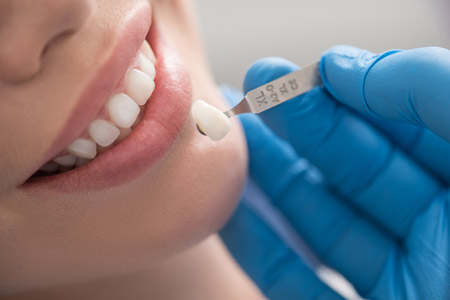 Dental crown