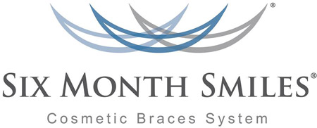 Six Month Smiles clear braces