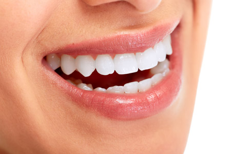 Cosmetic dentistry veneers example